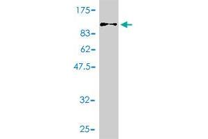 Western Blot detection against Immunogen (91. (GAD Antikörper  (AA 1-594))