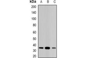 Western blot analysis of STAR expression in Jurkat (A), PC12 (B), mouse kidney (C) whole cell lysates. (STAR Antikörper)