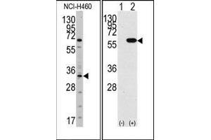 (LEFT)Western blot analysis of anti-YBX1 Antibody (N-term) in NCI-H460 cell line lysates (35ug/lane). (YBX1 Antikörper  (N-Term))