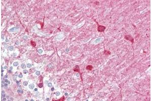 Anti-PACSIN1 antibody IHC staining of human brain, cerebellum.
