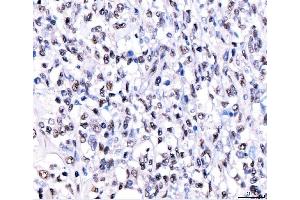 IHC analysis of CRTC3 using anti-CRTC3 antibody (ABIN7599779). (CRTC3 Antikörper  (AA 116-619))