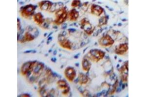 Immunohistochemistry (IHC) image for anti-Integrin, alpha E (Antigen CD103, Human Mucosal Lymphocyte Antigen 1, alpha Polypeptide) (ITGAE) (AA 671-917) antibody (ABIN7439705)