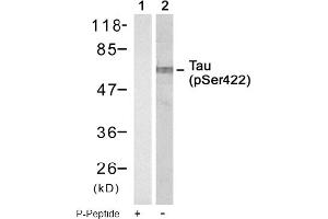 Image no. 1 for anti-Microtubule-Associated Protein tau (MAPT) (pSer422) antibody (ABIN319250) (MAPT Antikörper  (pSer422))