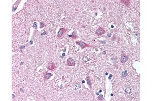 Immunohistochemistry (IHC) image for anti-Wingless-Type MMTV Integration Site Family, Member 9A (WNT9A) (N-Term) antibody (ABIN1049488)