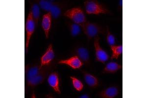Immunofluorescence (IF) image for anti-Keratin 1 (KRT1) antibody (ABIN7449048)