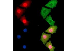ABIN7095267 and ABIN7099324 staining Hela cells by IF/ICC. (LTC4S Antikörper)