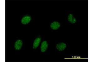 Immunofluorescence of purified MaxPab antibody to NPAS2 on HeLa cell.