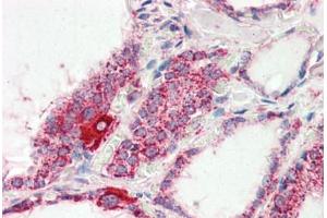 Human Thyroid (formalin-fixed, paraffin-embedded) stained with COX4I1 antibody ABIN461950 at 2. (COX IV Antikörper  (AA 154-166))
