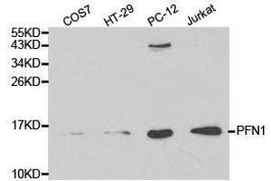 Western Blotting (WB) image for anti-Profilin 1 (PFN1) antibody (ABIN1874102) (PFN1 Antikörper)