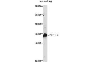 Western blot analysis of extracts of mouse lung, using PKD1L2 antibody. (PKD1L2 Antikörper)