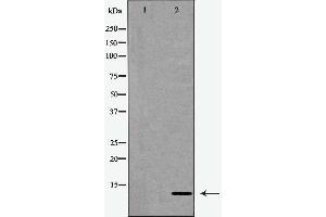 Western blot analysis of extracts from Jurkat cells, treated with serum (20%, 15mins), using CKS1 antibody. (CKS1 Antikörper  (N-Term))