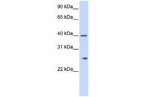 WB Suggested Anti-GSTK1 Antibody Titration: 0. (GSTK1 Antikörper  (N-Term))