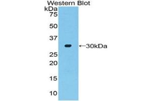 Western blot analysis of the recombinant protein. (ADCY2 Antikörper  (AA 294-525))