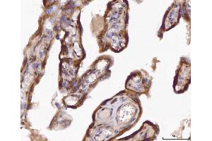 IHC analysis of ABP1/AOC1 using anti-ABP1/AOC1 antibody (ABIN4886460).