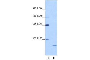 WB Suggested Anti-ISG20  Antibody Titration: 1. (ISG20 Antikörper  (N-Term))