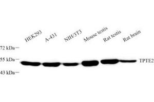 Western blot analysis of TPTE2 (ABIN7075990) at dilution of 1: 1000 (TPTE2 Antikörper)