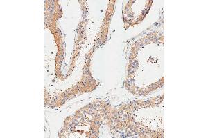 Immunohistochemical analysis of paraffin-embedded Human testis tissue using (ABIN1945086 and ABIN2838551) performed on the Leica® BOND RXm. (ALDH1A1 Antikörper  (AA 306-339))