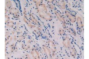 IHC-P analysis of Human Kidney Tissue, with DAB staining. (Vip Antikörper  (AA 29-165))