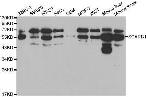 Western blot analysis of extracts of various cell lines, using SCARB1 antibody. (SCARB1 Antikörper  (AA 1-100))