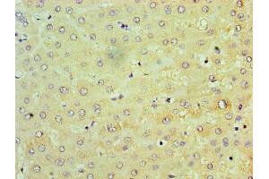 Immunohistochemistry of paraffin-embedded human liver tissue using ABIN7172247 at dilution of 1:100