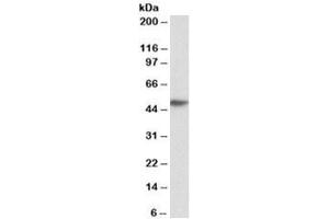 Western blot testing of human peripheral blood lymphocyte lysate with FCER1A antibody at 0. (Fc epsilon RI/FCER1A Antikörper)