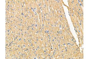 ABIN6265176 and ABIN6268795 at 1/100 staining Rat heart tissue by IHC-P. (SMAD4 Antikörper  (N-Term))