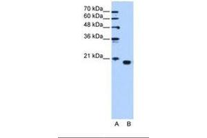 Image no. 1 for anti-Phosphatidylethanolamine Binding Protein 1 (PEBP1) (C-Term) antibody (ABIN321403) (PEBP1 Antikörper  (C-Term))