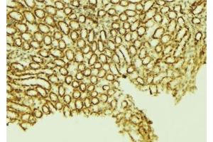 ABIN6276597 at 1/100 staining Mouse kidney tissue by IHC-P. (FHIT Antikörper  (Internal Region))