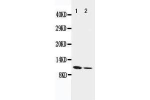 Anti-Resistin antibody, Western blotting Lane 1: Recombinant Mouse Resistin Protein 10ng Lane 2: Recombinant Mouse Resistin Protein 5ng (Resistin Antikörper  (C-Term))