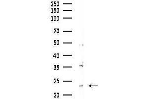anti-Transcription Elongation Factor A (SII)-Like 5 (TCEAL5) (Internal Region) antibody