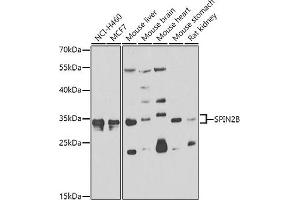 Western blot analysis of extracts of various cell lines, using SPIN2B antibody  at 1:1000 dilution. (Spindlin 2B Antikörper  (AA 1-258))