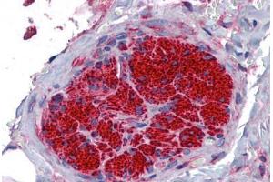 Human Peripheral Nerve: Formalin-Fixed, Paraffin-Embedded (FFPE) (SGCB Antikörper  (AA 87-197))