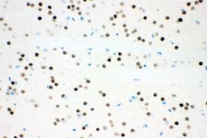 IHC analysis of Ataxin 1 using anti-Ataxin 1 antibody (ABIN3043506).