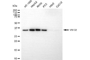 anti-V-Set and Immunoglobulin Domain Containing 2 (VSIG2) antibody