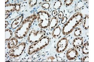 Immunohistochemical staining of paraffin-embedded Human thyroid tissue using anti-BDH2 mouse monoclonal antibody. (BDH2 Antikörper)
