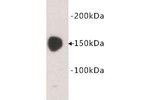 Western Blotting (WB) image for anti-Carcinoembryonic Antigen Gene Family (CEA) antibody (ABIN1854846) (CEA Antikörper)