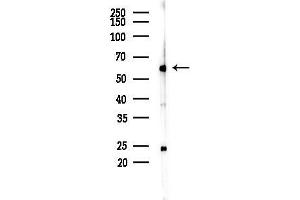 anti-Preferentially Expressed Antigen in Melanoma (PRAME) (C-Term) antibody