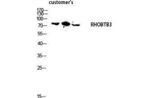 Western Blot (WB) analysis of lysis using RHOBTB3 antibody. (RHOBTB3 Antikörper  (Internal Region))
