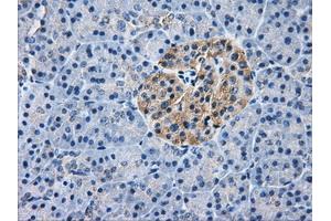 Immunohistochemical staining of paraffin-embedded liver tissue using anti-AKR1A1mouse monoclonal antibody. (AKR1A1 Antikörper)