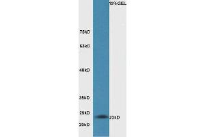Western Blotting (WB) image for anti-BCL2-Antagonist/killer 1 (BAK1) (AA 21-120) antibody (ABIN674409)