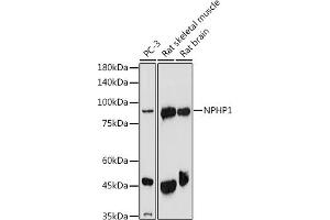 Western blot analysis of extracts of various cell lines, using NPHP1 antibody (ABIN6128349, ABIN6144768, ABIN6144769 and ABIN6222377) at 1:1000 dilution. (NPHP1 Antikörper  (AA 345-614))