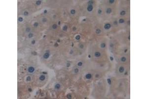 IHC-P analysis of Human Tissue, with DAB staining. (SPP2 Antikörper  (AA 30-211))