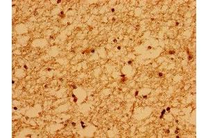 Immunohistochemistry of paraffin-embedded human brain tissue using ABIN7175718 at dilution of 1:100 (WDPCP Antikörper  (AA 621-737))