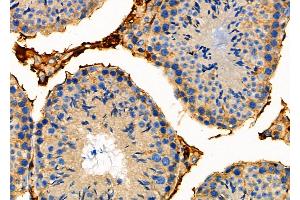 ABIN6259349 and ABIN6275564 at 1/100 staining Mouse testis tissue by IHC-P. (STAC2 Antikörper  (Internal Region))