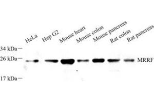 Western blot analysis of MRRF (ABIN7074657) at dilution of 1: 1000 (MRRF Antikörper)