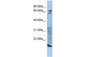 ZP1 antibody used at 1 ug/ml to detect target protein. (ZP1 Antikörper)