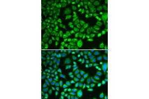 Immunofluorescence analysis of MCF-7 cells using PSMD7 antibody (ABIN5973092). (PSMD7 Antikörper)