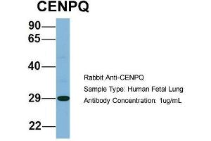 Host: Rabbit  Target Name: CENPQ  Sample Tissue: Human Fetal Lung  Antibody Dilution: 1. (CENPQ Antikörper  (N-Term))