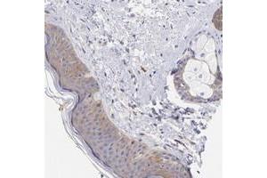 Immunohistochemical staining of human skin with PPFIBP1 polyclonal antibody  shows moderate cytoplasmic positivity in epidermal cells and adnexal cells at 1:200-1:500 dilution. (PPFIBP1 Antikörper)