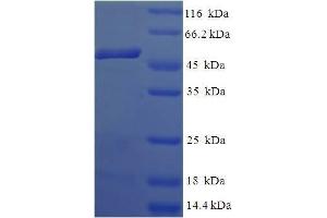 SDS-PAGE (SDS) image for Cytokine Induced Apoptosis Inhibitor 1 (CIAPIN1) (AA 1-312), (full length) protein (His-SUMO Tag) (ABIN5711429)
